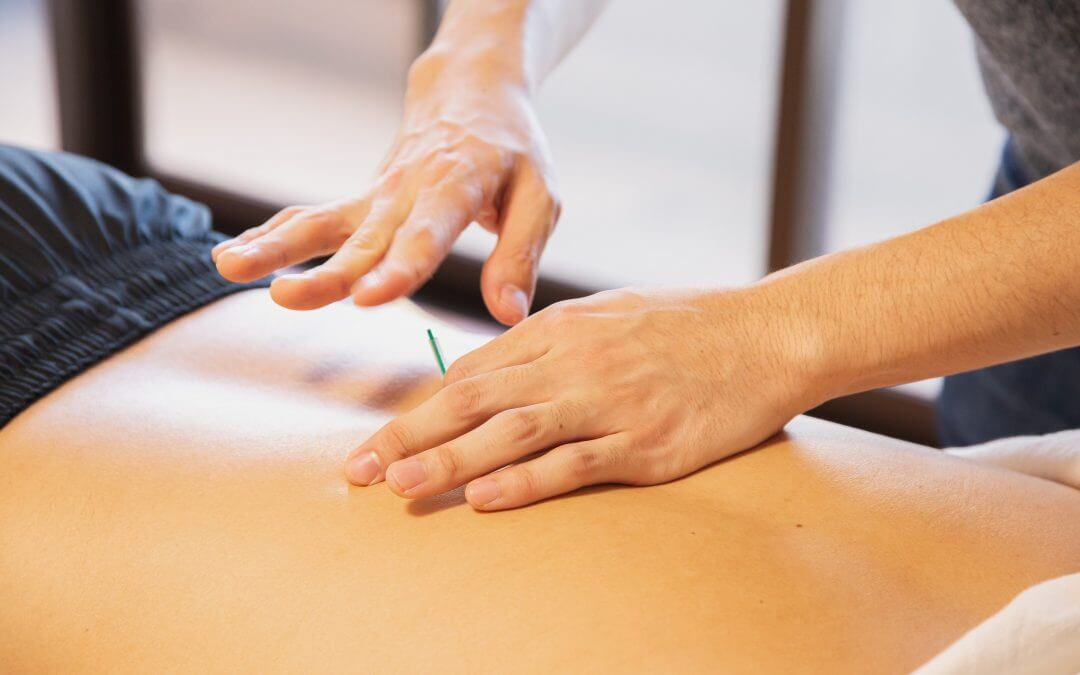 Dry Needling, Pro7 Wellness, Shanmukh Beldore, Therapy